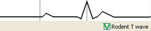 ECG, quando la funzione ratto o topo