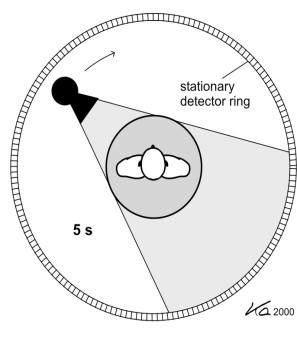 Figura 3.5. IV generazione 3.4. Spiral TC ed evoluzioni I moderni tomografi presentano sistemi di TC elicoidale (Spiral CT).