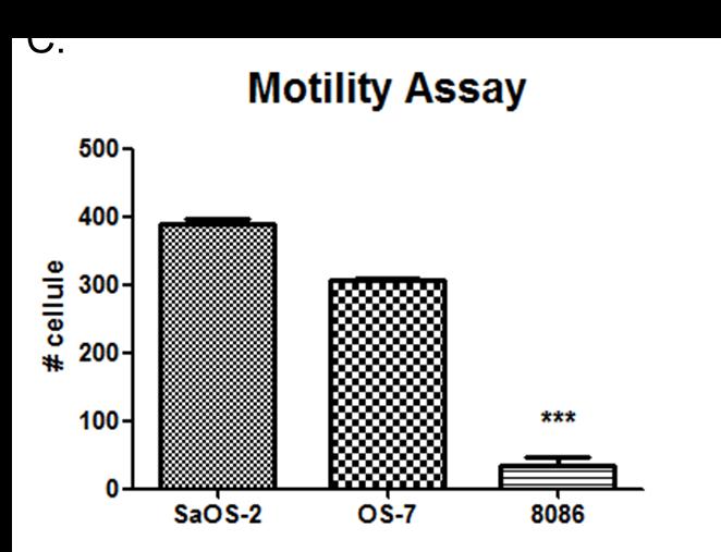 Risultati differenziamento osteoblastico di SaOS-2 (A) ed MSCs (B) dopo l utilizzo dell anticorpo (*,p 0.05; ***, p 0.001). Importanza di IRS-1 durante il differenziamento osteoblastico.