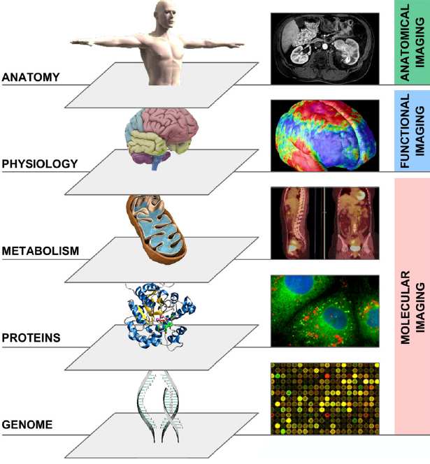 3 rivoluzioni tecnologiche in Radioterapia 1. Inizio anni 90 PIANIFICAZIONE3D-CRT 2.