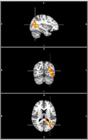 Hutton, Horowitz_Kraus et al.