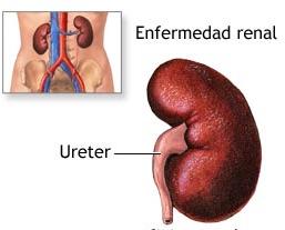 funzione dei reni -aumento della pressione arteriosa E una della