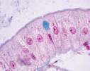 APOPTOSI Morte cellulare programmata corretto sviluppo dell organismo omeostasi tissutale risposta cellulare a stress / patogeni 2011 J.F.