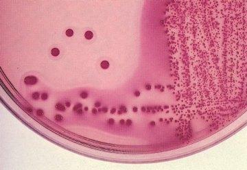 Lattosio non fermentanti Lattosio fermentanti Salmonella-Shigella Agar (Agar SS) Terreno altamente selettivo e differenziale per l isolamento di Salmonella e Shigella dalle feci e da campioni di