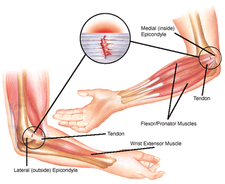 Muscoli delle dita Tutto ciò ci fa comprendere che i muscoli estensori dovrebbero essere allenati almeno quanto i flessori e spiega