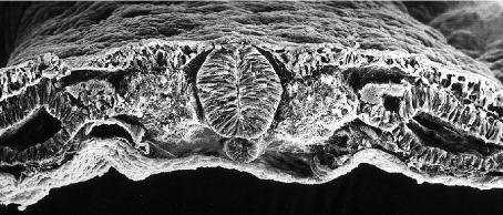 neurali (neuroni e glia) Cellule della midollare del surrene