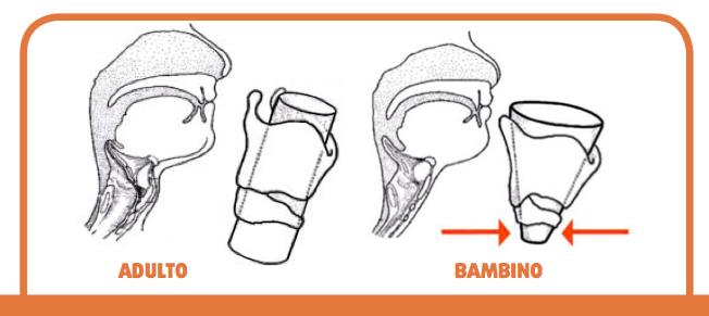 Cause predisponenti L anatomia delle vie aeree del bambino