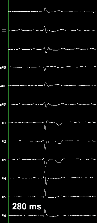 circuits: figure