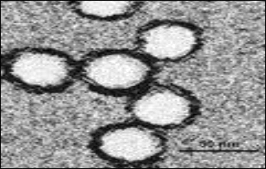 West Nile virus Il West Nile virus (WNV) rientra nel gruppo degli Arbovirus (Arthropod Borne viruses), appartiene al genere Flavivirus, famiglia Flaviviridae, in cui sono compresi circa 70 virus, la