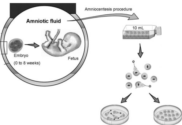 liquido amniotico (AFSCs).