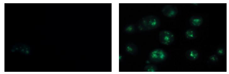 A CTR 15 µm PN 1 h 15 µm PN 4 h 15 µm PN 8 h 15 µm PN 16 h B C D Figura 13: Il PN determina autofagia nelle cellule MDA-MB231. (A-C) Valutazione della comparsa di vacuoli autofagici.