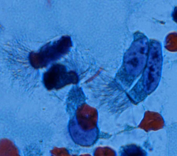 1) Cellule caliciformi mucipare 2) Epitelio cilindrico ciliato 3) Ghiandole acinari a secrezione sieromucosa 4)