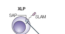 SINDROME LINFOPROLIFERATIVA LEGATA AL CROMOSOMA X (XLP) SH2D1A gene: SLAM-Associated Protein (SAP), Signalling Lymphocytic Activation Molecule (SLAM) Esempio di patologia in cui un difetto