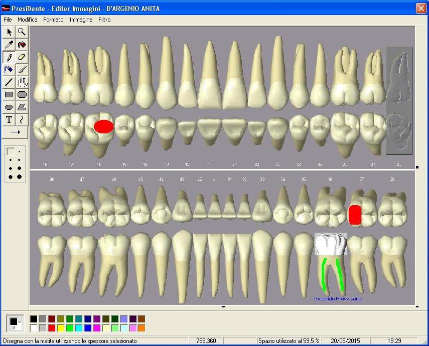 What Cosa? Disegno e memorizzazione di schemi dentali personalizzati associati ai pazienti.