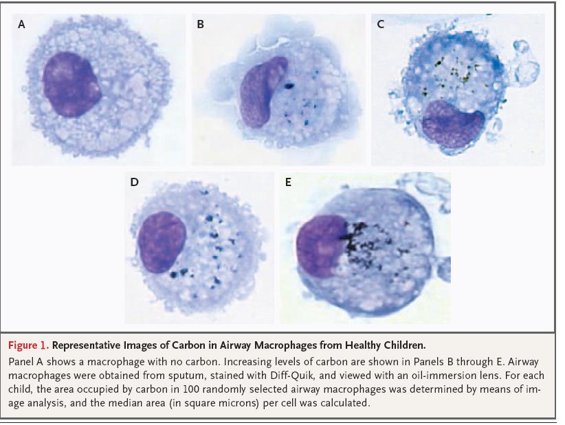 Fine particles (PM 2,5-10) in healthy children white cells (NEJM 2006) UP passano sia la membrana cellulare che