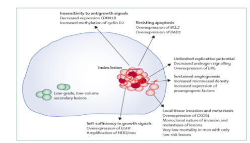 1. Invest in reducing clinical uncertainties LA TERAPIA DEL CARCINOMA PROSTATICO A