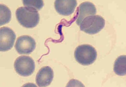 Flagellated protozoan parasites Colored