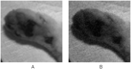 Analisi dei Risultati ranno necessarie piú informazioni per l evoluzione corretta del filtro, da qui la scelta di utilizzare delle immagini campione di dimensione maggiore (che ovviamente implicano