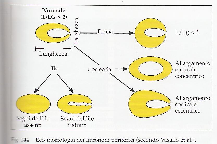 Ecografia