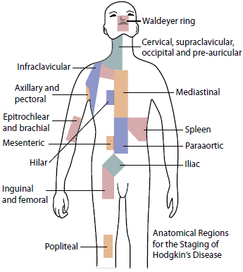 Diagnostic Workup History Complete physical examination Confirmatory workup Ø Excisional biopsy of