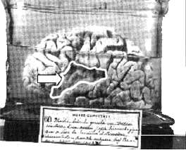 Il cervello, il linguaggio e la grammatica Che il linguaggio dipenda dal cervello è noto almeno dalla metà dell ottocento. La domanda nuova è se anche il tipo di grammatica dipenda dal cervello.