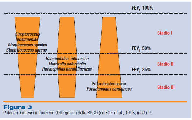 Eziologia