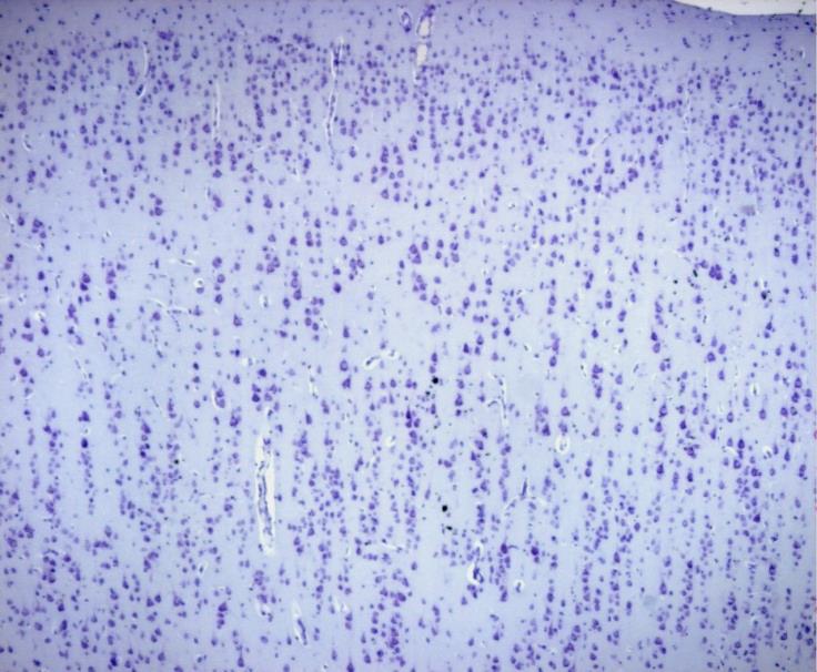 R.R. Neuropathology: cortical layer