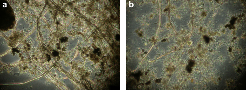 Fibre di cellulosa componente essenziale della carta igienica costituiscono circa