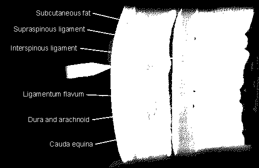 L'anestesia