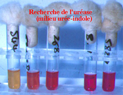 Test ureasi Il test dell'ureasi avviene su terreni di Christensen (contenenti urea). Si fa un pesante inoculo.