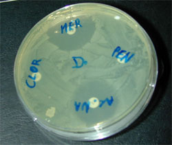 L antibiogramma: le tecniche Le varie tecniche per eseguire questo tipo di test sono sostanzialmente riconducibili a due metodi principali: Nel metodo della diffusione in agar il microrganismo in