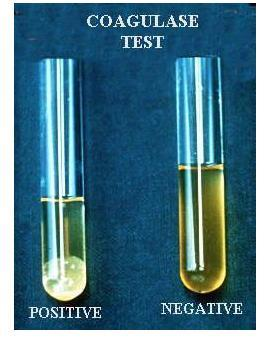 Test di attività della COAGULASI Per l identificazione di S.