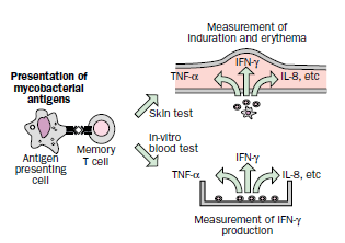 Interferon Gamma Release Assay