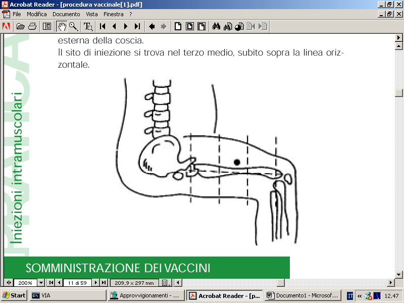 presumibilmente perché l iniezione può essere inavvertitamente effettuata nel sottocutaneo o nel tessuto adiposo profondo.