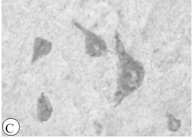 Choline Alphoscerate, between cholinergic precursors, induces, in animal models, the higher increase in the levels of acetylcholine.