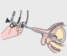 determinare irregolarità nella scarica ed errori nella pratica chirurgica.