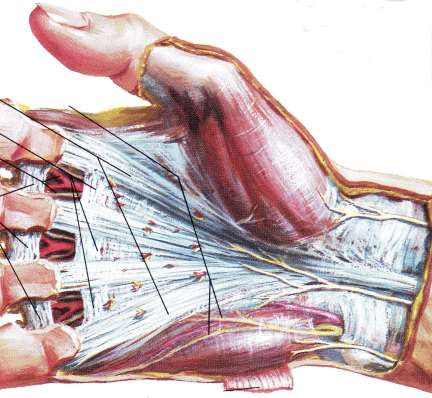 6 Morbo Dupuytren ispessimento/retrazione fascia palmare deformità in flessione articolazioni