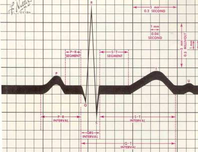 Tratto PQ QRS Rotazione