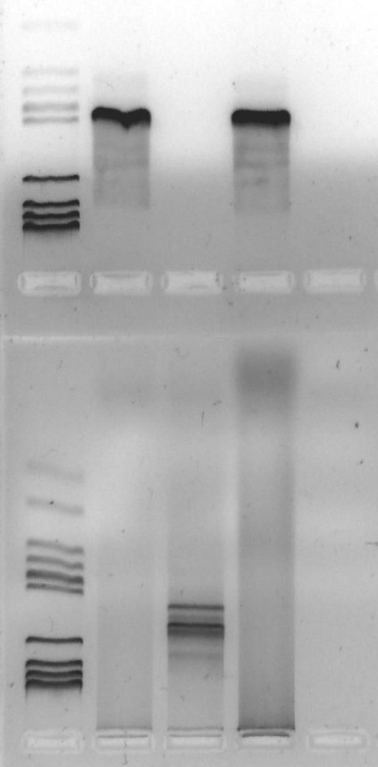 Fusion of FIP1L1 to PDGFRA ACTINA FIP1L1/PDGFRa POSITIVE CONTROL