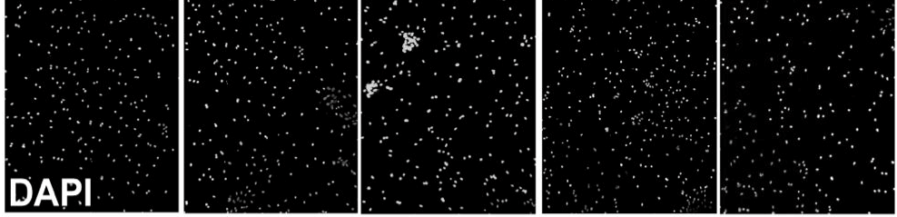 Neuroni Glia Vitalità cellulare [Nps]= 625 µg/ml ; [ZN2+]= 250 µm Zn Zn Cellule trattate MAP2: marker