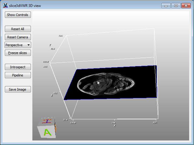 Il primo blocco funzionale, chiamato DICOMReader, rappresenta i dati di input, i quali vengono collegati tramite la prima uscita all ingresso del blocco slice3dvwr : un sistema di visualizzazione che