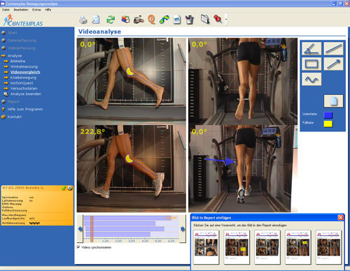 CONTEMPLAS può inoltre fornire un sistema di analisi video aggiornato con le ultime tecnologie video/immagine e si colloca come soluzione perfetta per l analisi clinica del passo e l analisi su