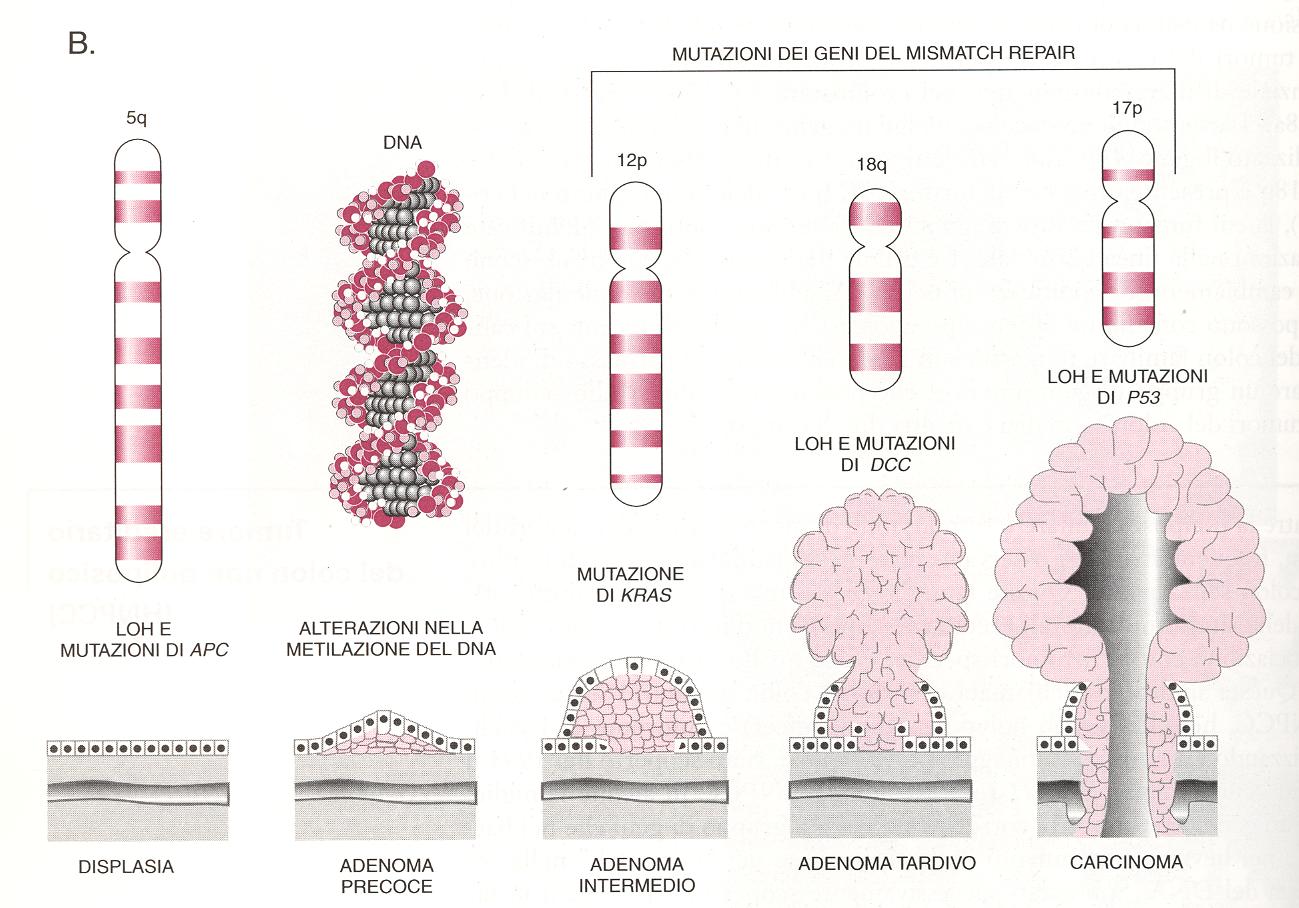 Il modello di Fearon e Vogelstein per lo sviluppo del carcinoma