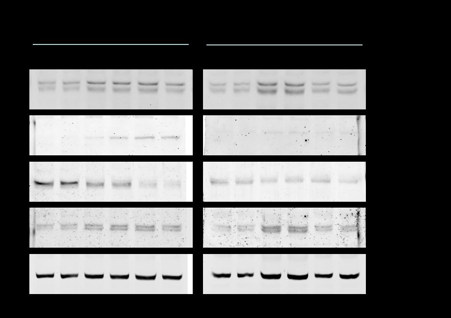 L attivazione del fattore NF-kB è stata anche valutata attraverso test TransAm (l NFkB Family kit (Active Motif) TransAm, Roches, Milano Italia).