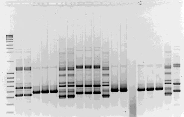 attraverso analisi degli spaziatori ribosomali Estrazione del DNA