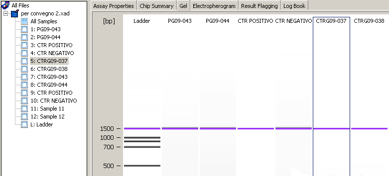 Analisi qualitativa DNA AF4 PLZF RAG1 TBXAS La presenza