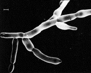 Figura 3- Cellule lievitiforni (a sinistra), tubi germinativi (al centro), forma miceliale costituita da vere ife (a destra).