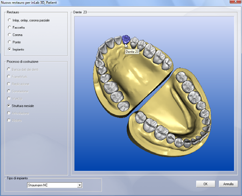 12 Trattamento di impianti con inlab 3D Sirona Dental Systems GmbH Processo di costruzione della struttura mesiale 12.