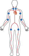 Emorragia: punti di compressione Nel disegno i pallini blu indicano i principali punti di compressione in caso di