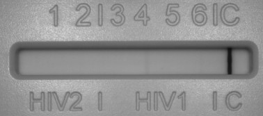 12/06/2015 HIV 1-2 Ag/Ab (CLIA): Positivo >12 Index HIV 1-2 Ab (CLIA): Positivo >50 Index HIV Ag p24